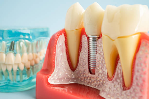 Best Cosmetic Dentistry  in Muscle Shos, AL